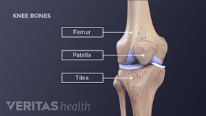 Illustration of the three knee bones: patella, femur and tibia