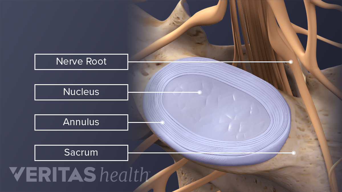 All About L5-S1 (Lumbosacral Joint) | Spine-health