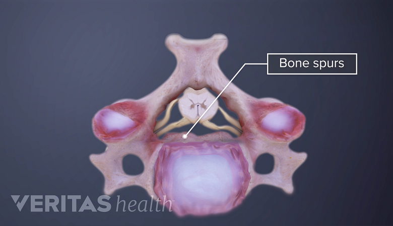 显示子宫脊柱骨纹