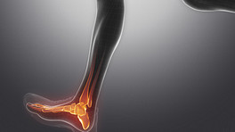 Ankle with bones showing pain in the foot