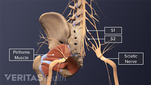 Posterior view of the buttocks labeling the piriformis muscle, S1, S2, and sciatic nerve.