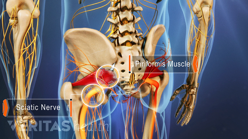 Animated video still of piriformis muscle and sciatic nerve