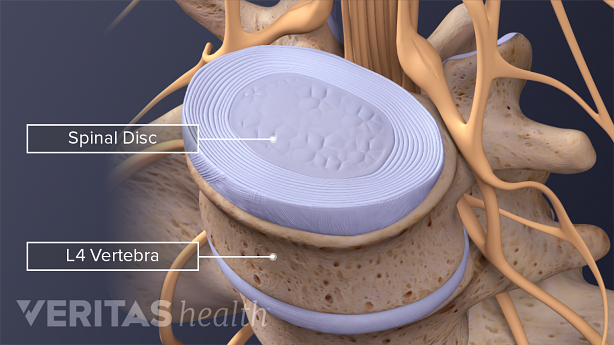 Illustration of lumbar disc from above and from the side view with anatomical labels.