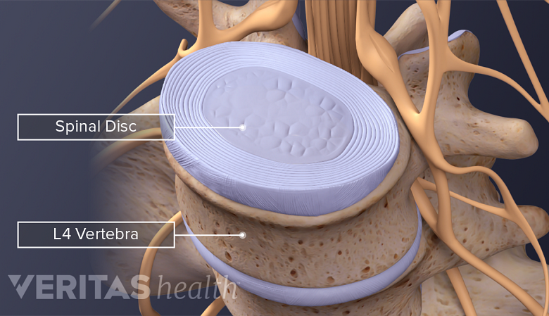 Illustration of lumbar disc from above and from the side view with anatomical labels.