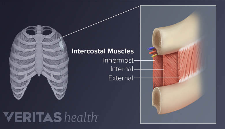 Medical illustration of intercostal muscle anatomy