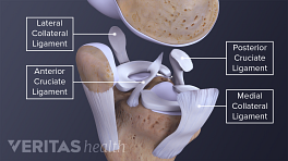 What are Medial Collateral Ligament (MCL) Tears & How to Recover? - Upswing  Health