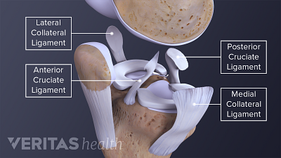 四个主要可以扭伤了膝盖韧带包括腓骨远侧韧带、后交叉韧带,前交叉韧带胫骨侧韧带。