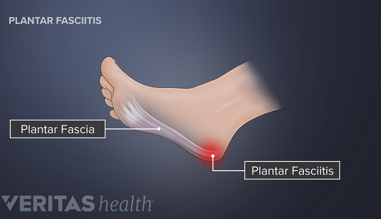 Pain between ankle and heel cheap