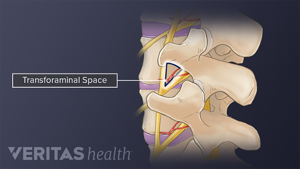 Profile view highlighting the transforaminal space in between vertebrae.