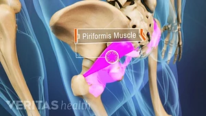 Back Pain: Relief with Piriformis Stretch - Memphis Physical Therapy