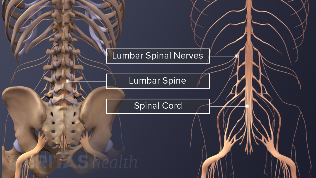 Multilevel Fusion Risks | Spine-health