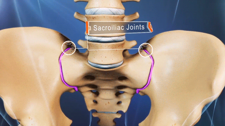 Anterior view of the pelvis labeling the SI Joints.