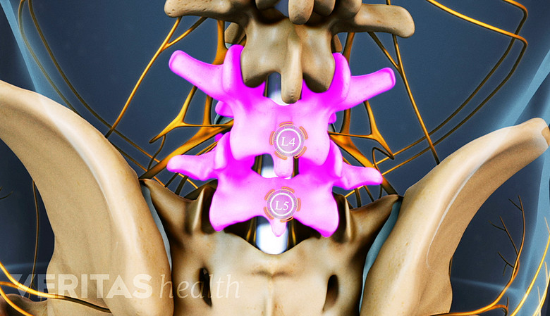 Lower spine with L4-L5 spinal segment highlighted.