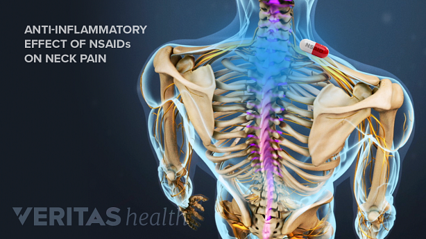 Medical illustration showing neck area in blue with a pill.