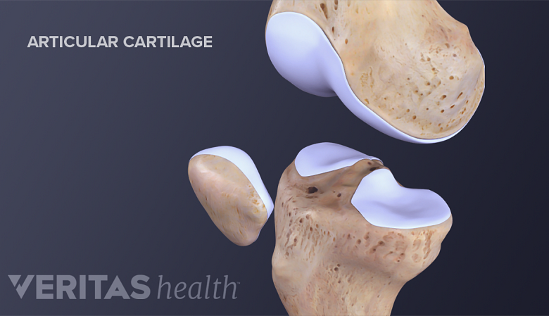 The articular cartilage in the knee.