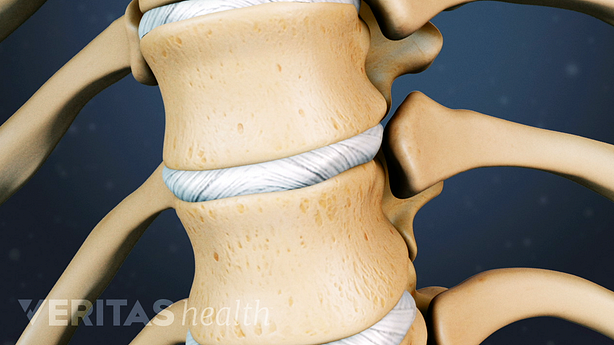 Anterior 3D view of a thoracic disc in between vertebrae.