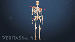 Medical illustration of a skeleton showing signs of scoliosis