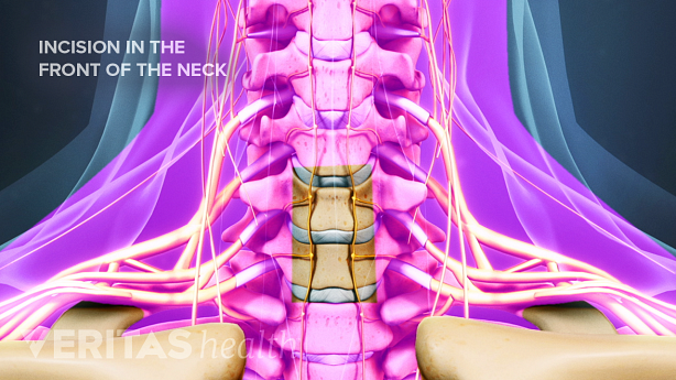 Illustration showing anterior view of cervical spine.