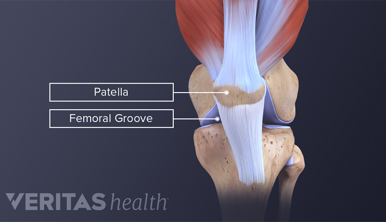 Illustration of anatomy of knee joint showing patella and femoral grove.