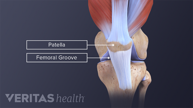 Anterior and profile view of a normal patellofemoral alignment labeling patella and femoral groove.