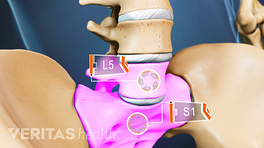 Skeletal view of the lumbar spine with L5 and S1 highlighted