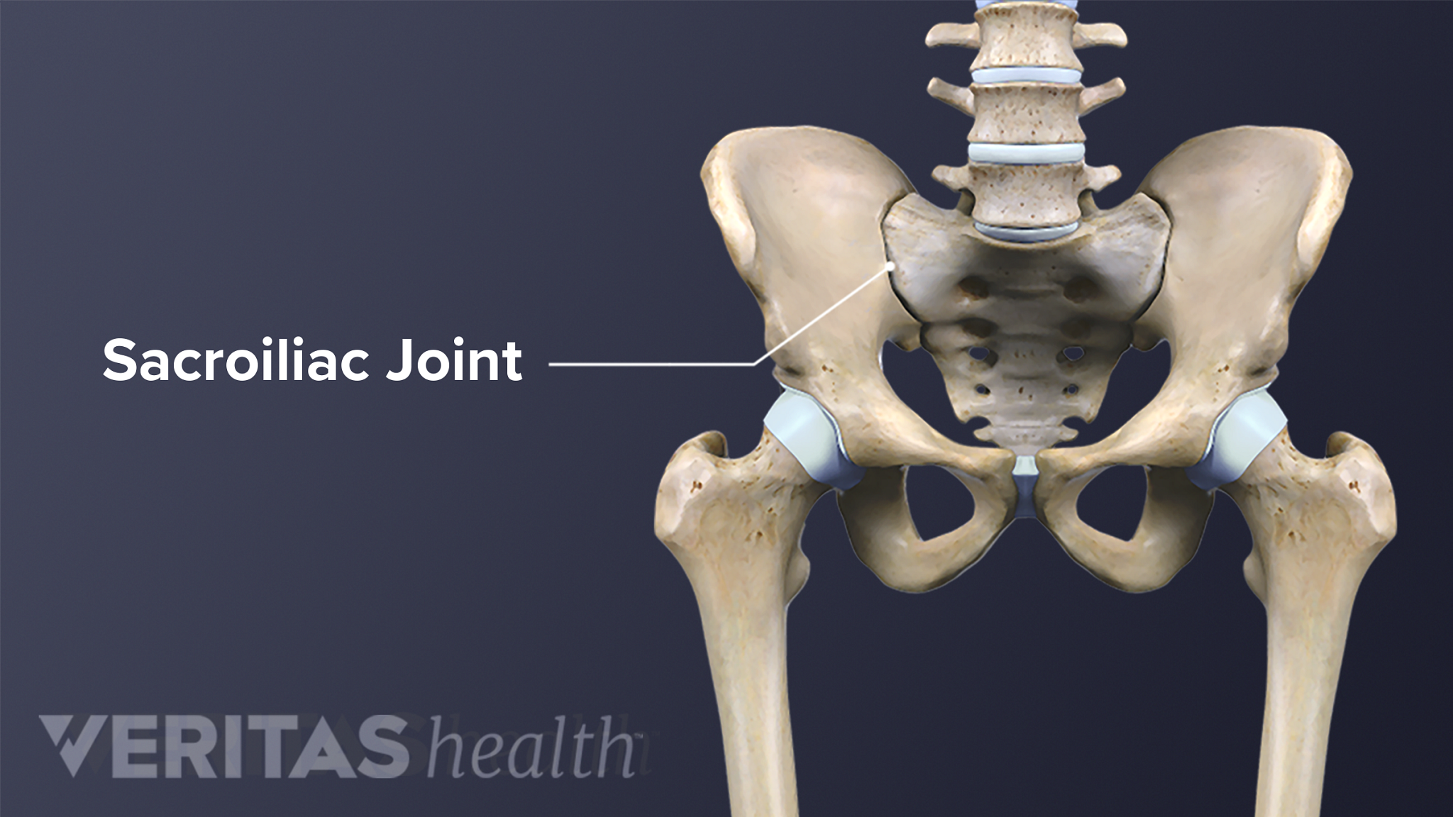 All About Sacroiliitis – An Tâm