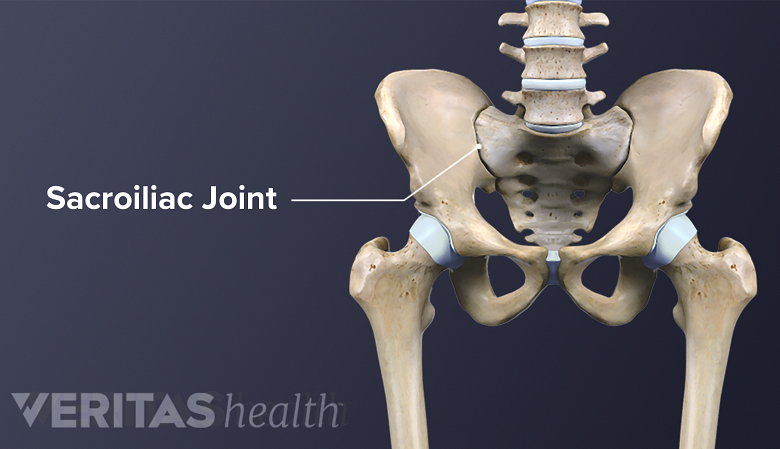 SI joint in the pelvis.