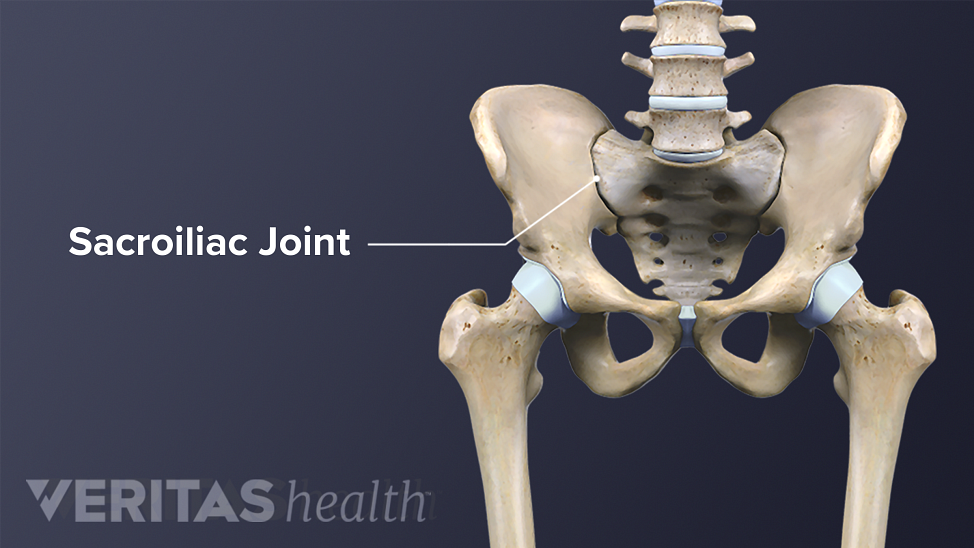 Anterior view of the SI JoInt labeling the sacroiliac joint