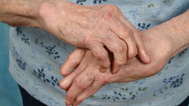 Arthritic hands massaging one another.