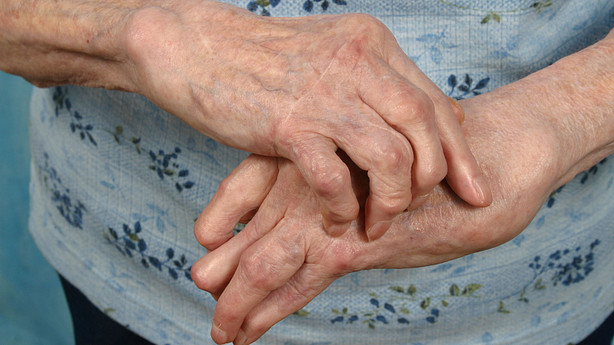 5 Simple Ways To Manage Hand Osteoarthritis | Arthritis-health 5 Simple Ways To Manage Hand Osteoarthritis | Arthritis-health