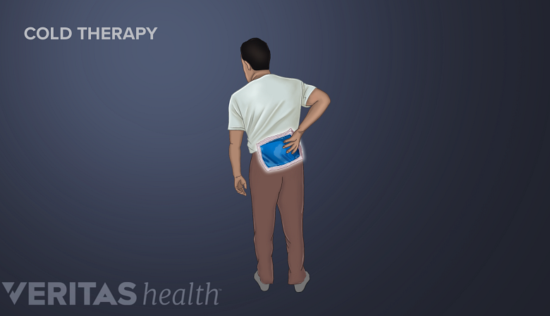 Cold therapy for lower back pain and sciatica.