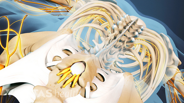 Medical illustration of the back, showing the SI Joint and spine