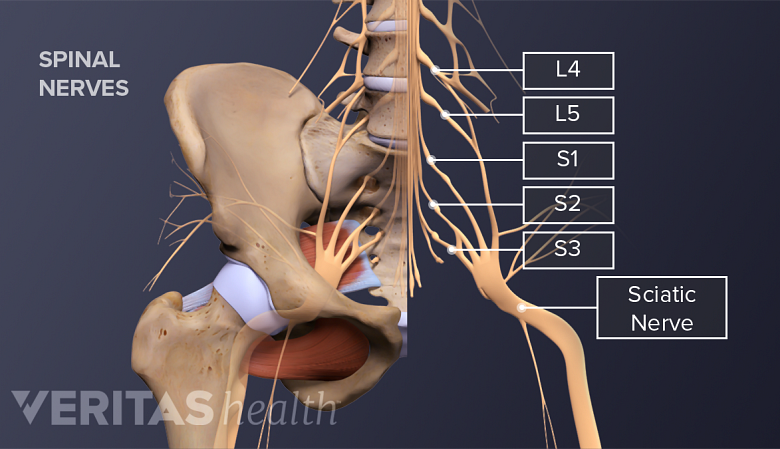 What is a Pinched Nerve in Lower Back?