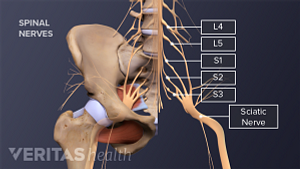 Vista anterior de la pelvis marcando L4, L5, S1, S2, S3 y el nervio ciático.