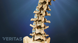 Posterior view of the lumbar spine showing curvature.