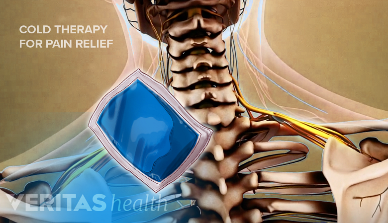 Illustration showing postrerior view of shoulder with a ice pack  icon.