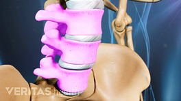 Profile view of the pelvis highlighting three vertebrae of the lumbar spine.