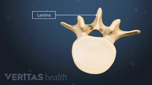 Spinal vertebra wtih lamina vertebrae.