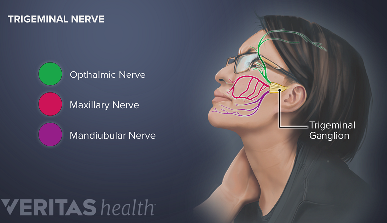 Illustration showing a woman holding her neck and trigeminal ganglion with its 3 branches ophthalmic, maxillary and mandibular nerve.