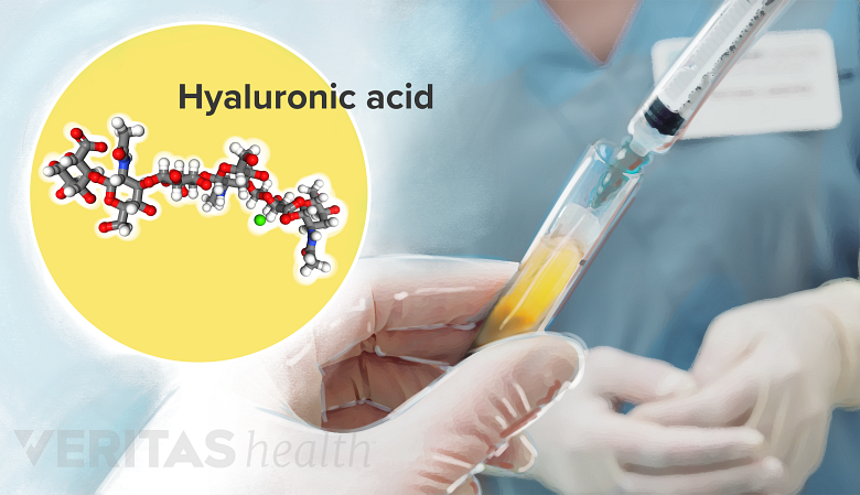 Illustration of hyaluronic acid injection and molecular composition