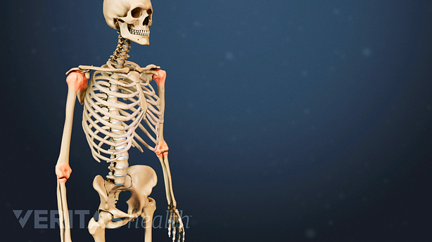 Illustrated skeleton with red highlights on the shoulder and elbow joints indicating pain