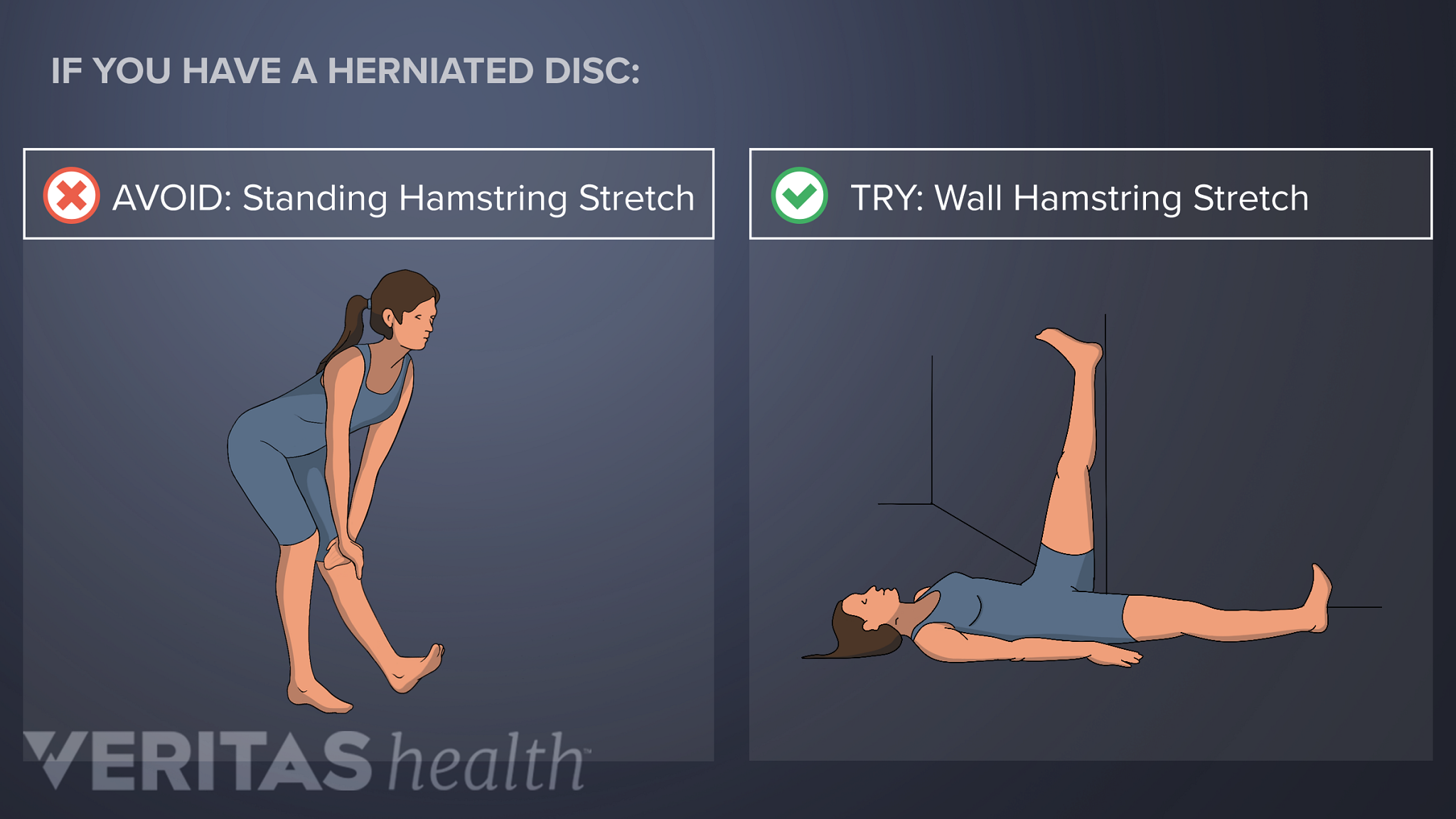 Core Exercises To Relieve Herniated Disc - DiscSeel - Non-Surgical Spine  Procedure