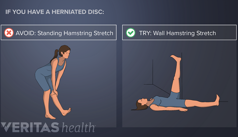 Avoid standing hamstring exercises with lower back disc herniation. Try a wall hamstring stretch.