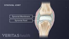 Medical illustration of the synovial membrane and synovial fluid in the knee