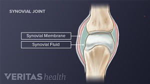 Medical illustration of the synovial membrane and synovial fluid in the knee