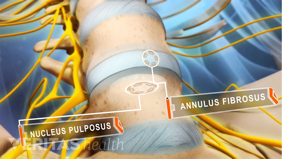 Animated video still showing the anatomy of a spinal disc