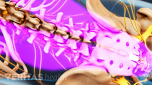 Posterior view of the lumbar spine highlighting pain in the lower back.