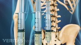 Three syringes used as a medial nerve block