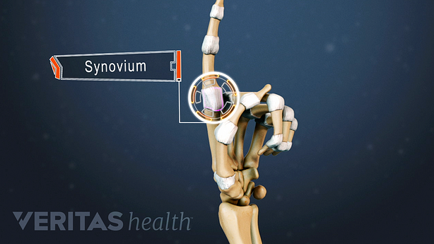 Hand anatomy highlighting the synovium