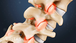 Vértebras de la columna que muestran dolor en las articulaciones facetarias